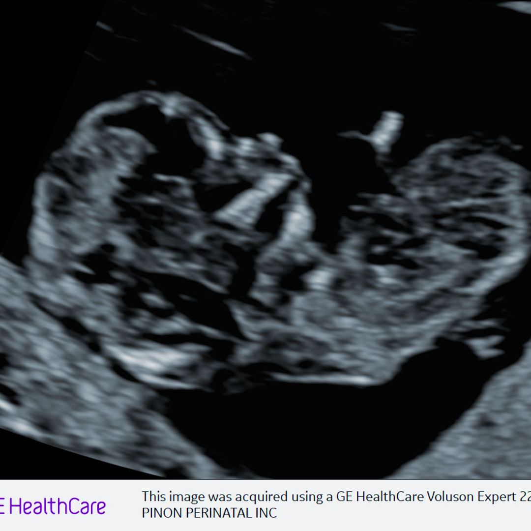 Photo shared by Devine for their Babylist baby registry.