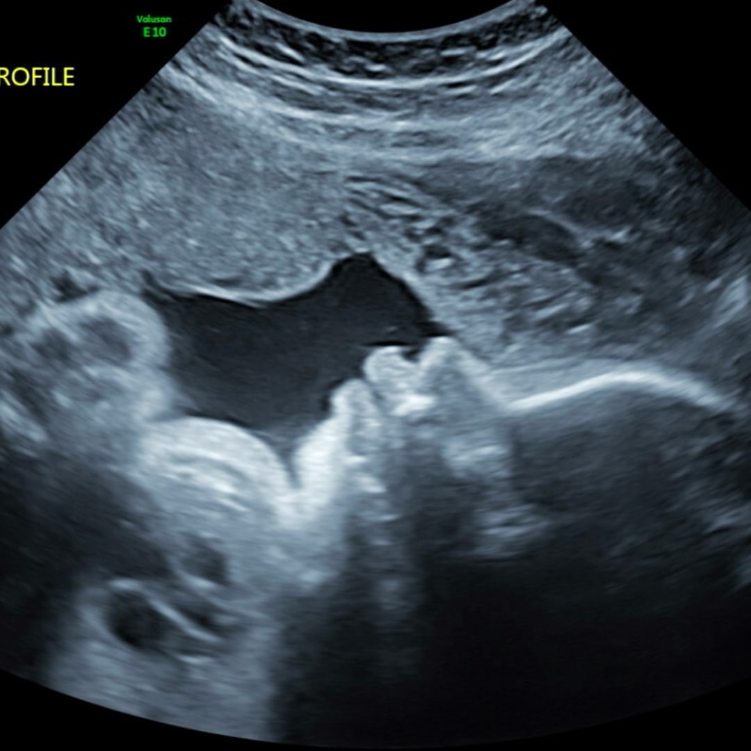 Photo shared by Alannah for their Babylist baby registry.