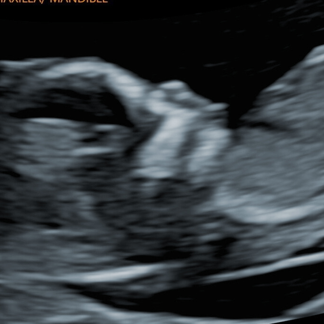 Photo shared by Dakota Star for their Babylist baby registry.