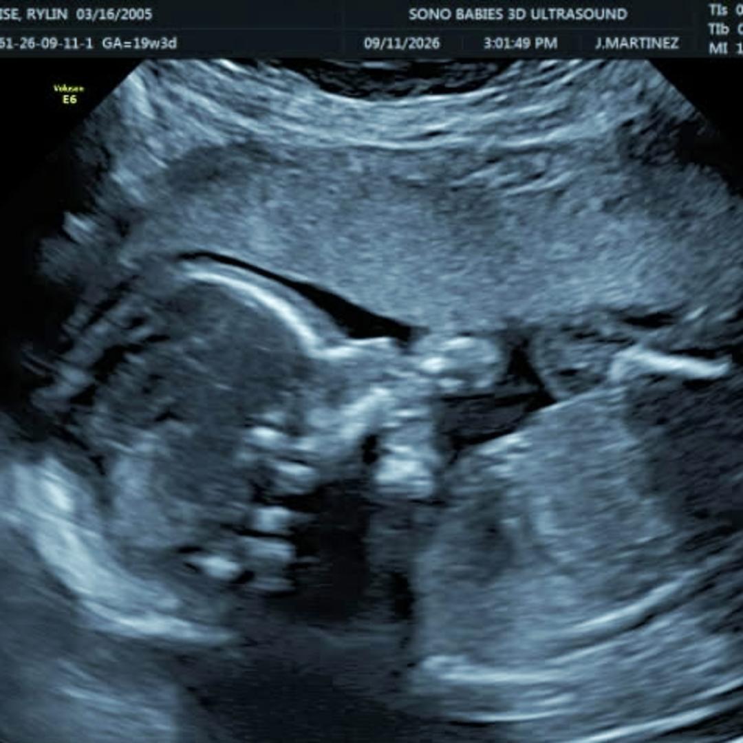 Photo shared by Rylin for their Babylist baby registry.