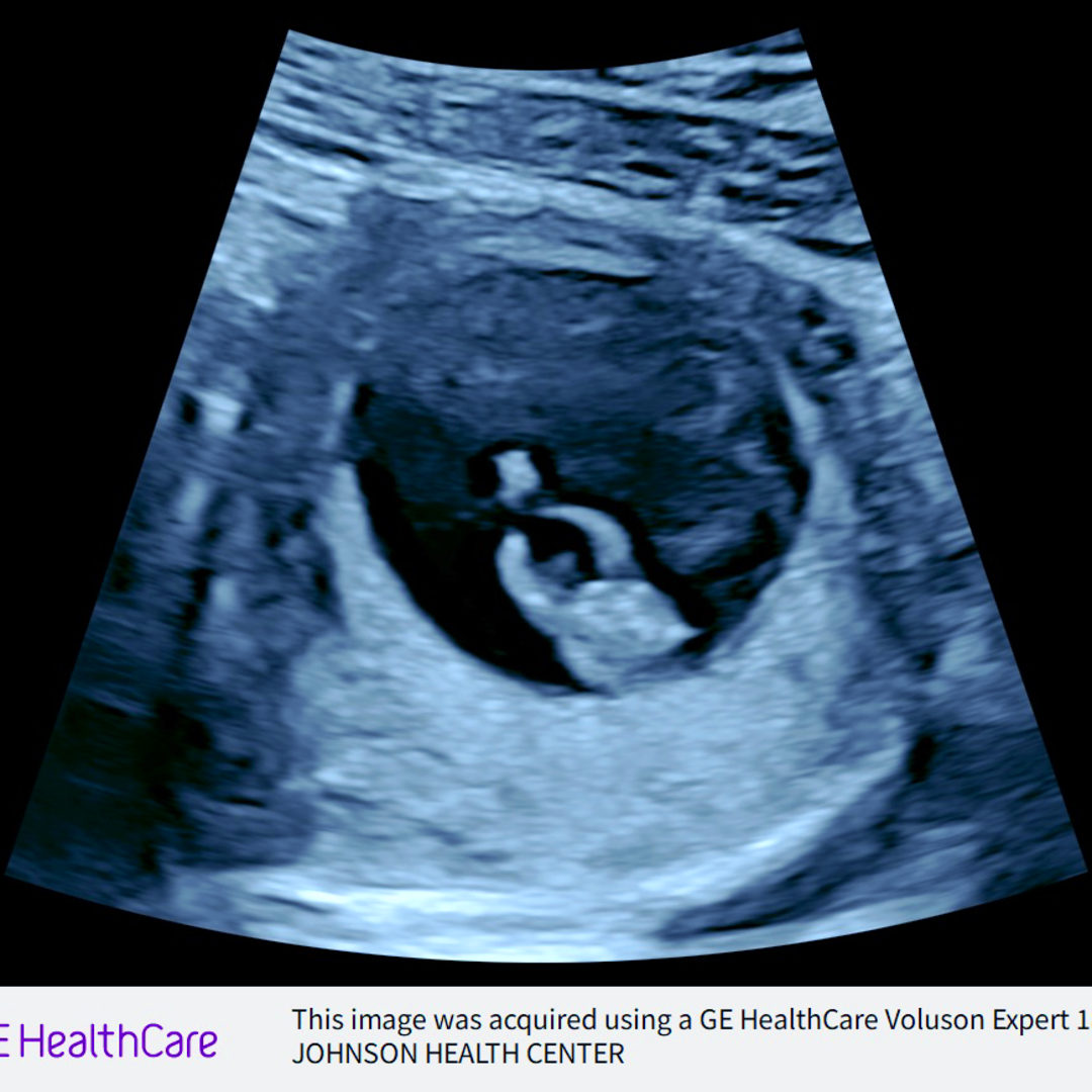 Photo shared by Ashley for their Babylist baby registry.