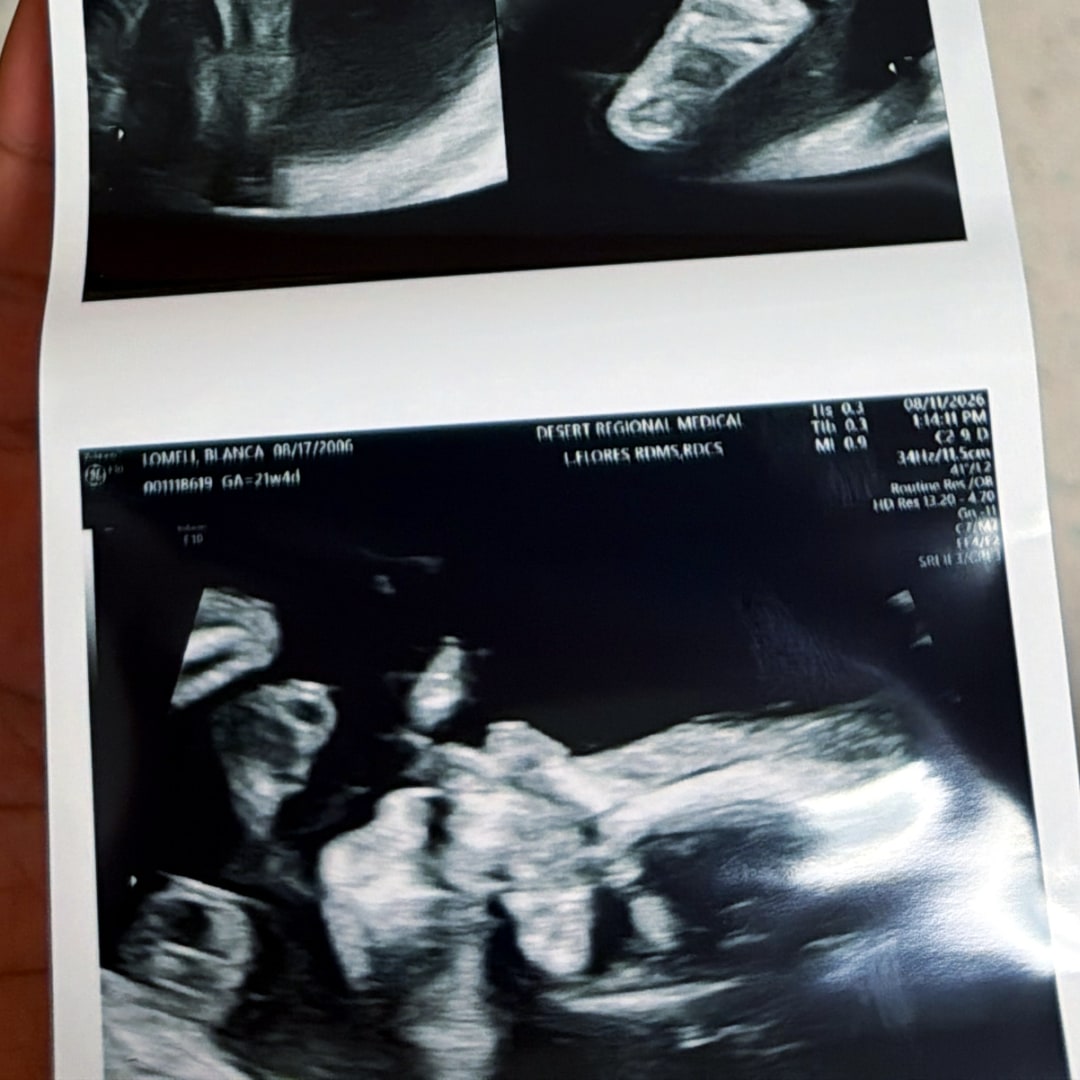 Photo shared by Blanca for their Babylist baby registry.