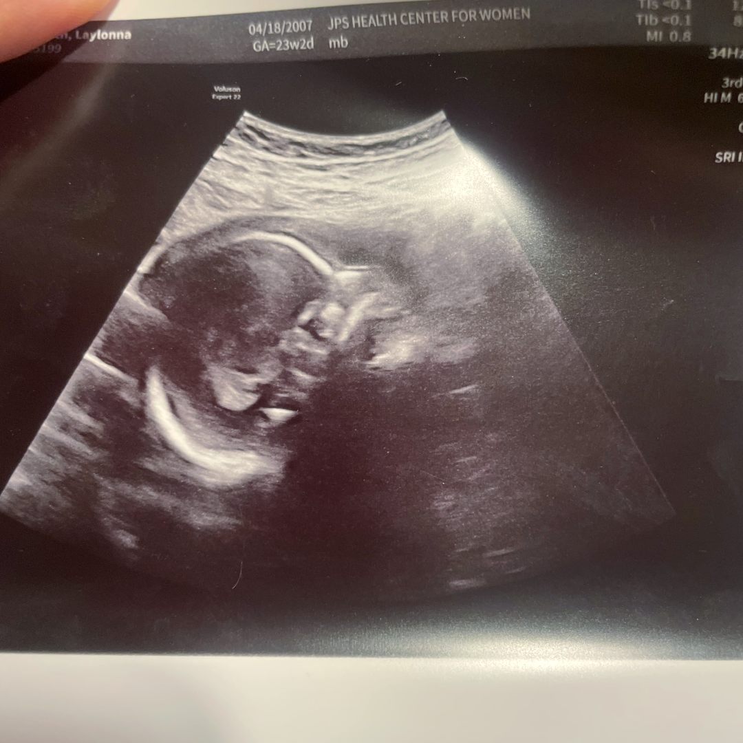 Photo shared by Laylonna for their Babylist baby registry.