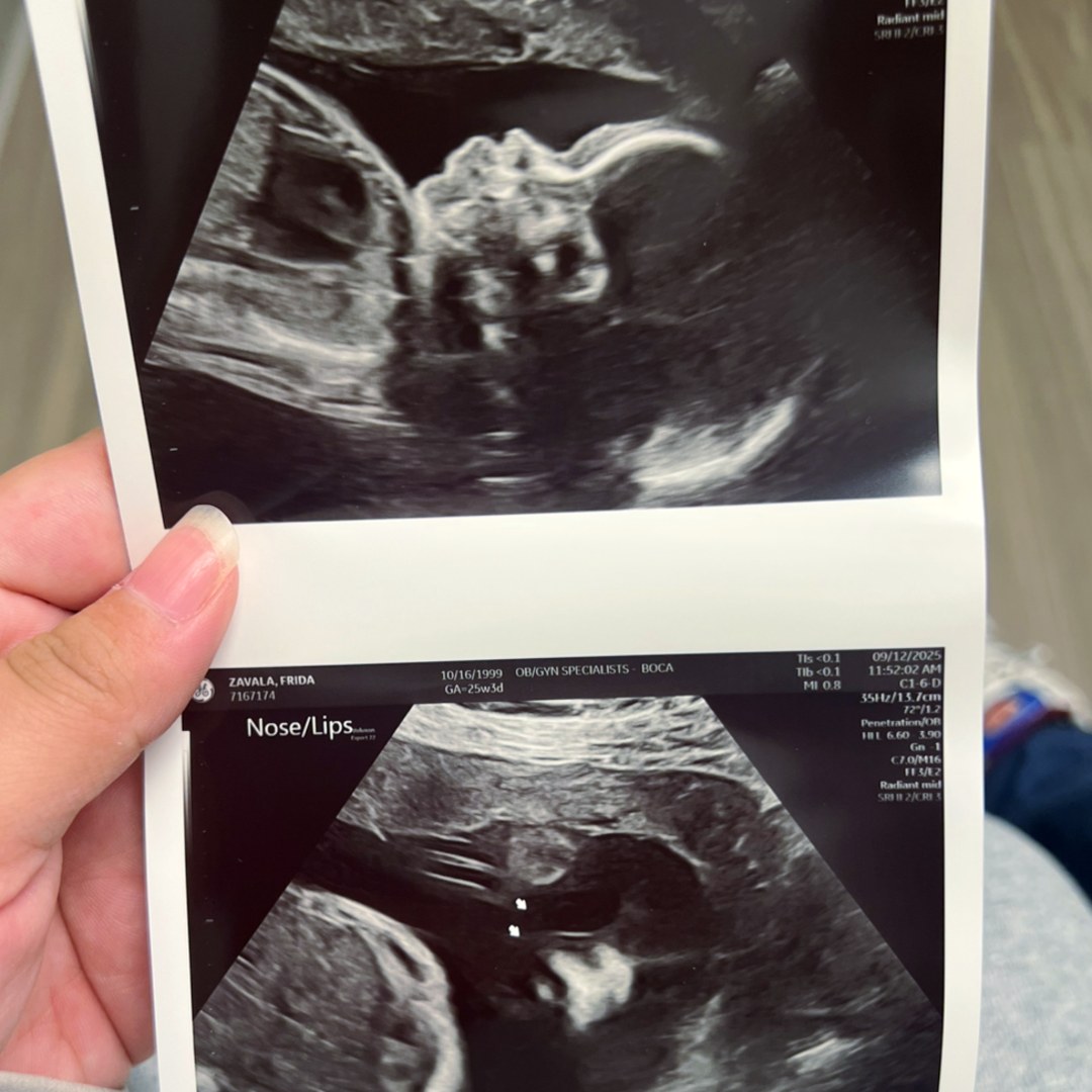 Photo shared by Frida for their Babylist baby registry.