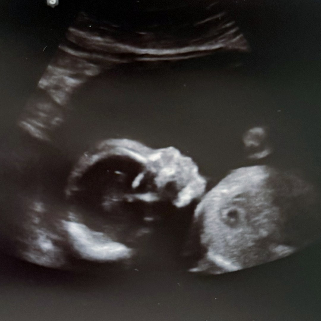 Photo shared by Pat & Tif for their Babylist baby registry.