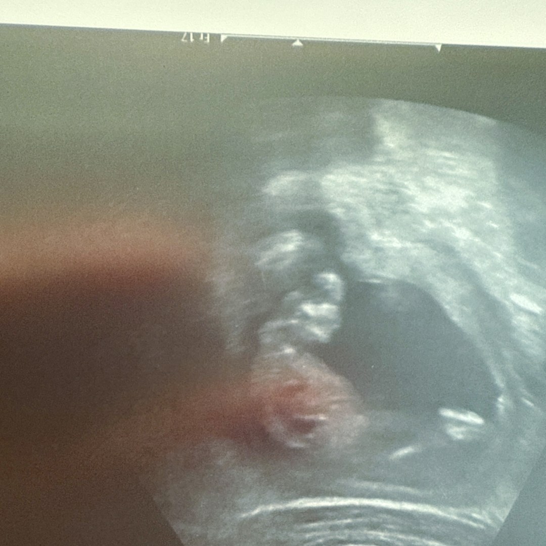 Photo shared by Cora for their Babylist baby registry.