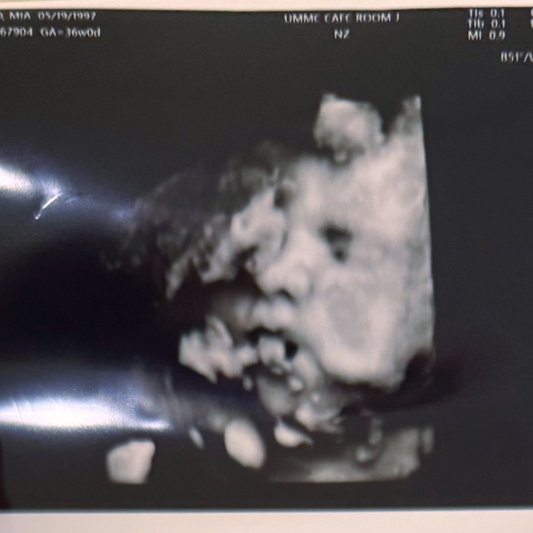 Photo shared by Mia for their Babylist baby registry.