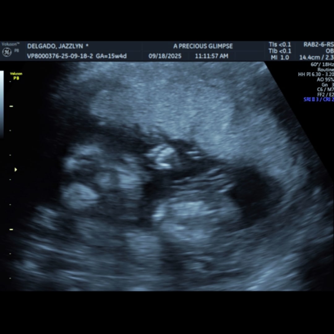 Photo shared by Jazzlynn for their Babylist baby registry.