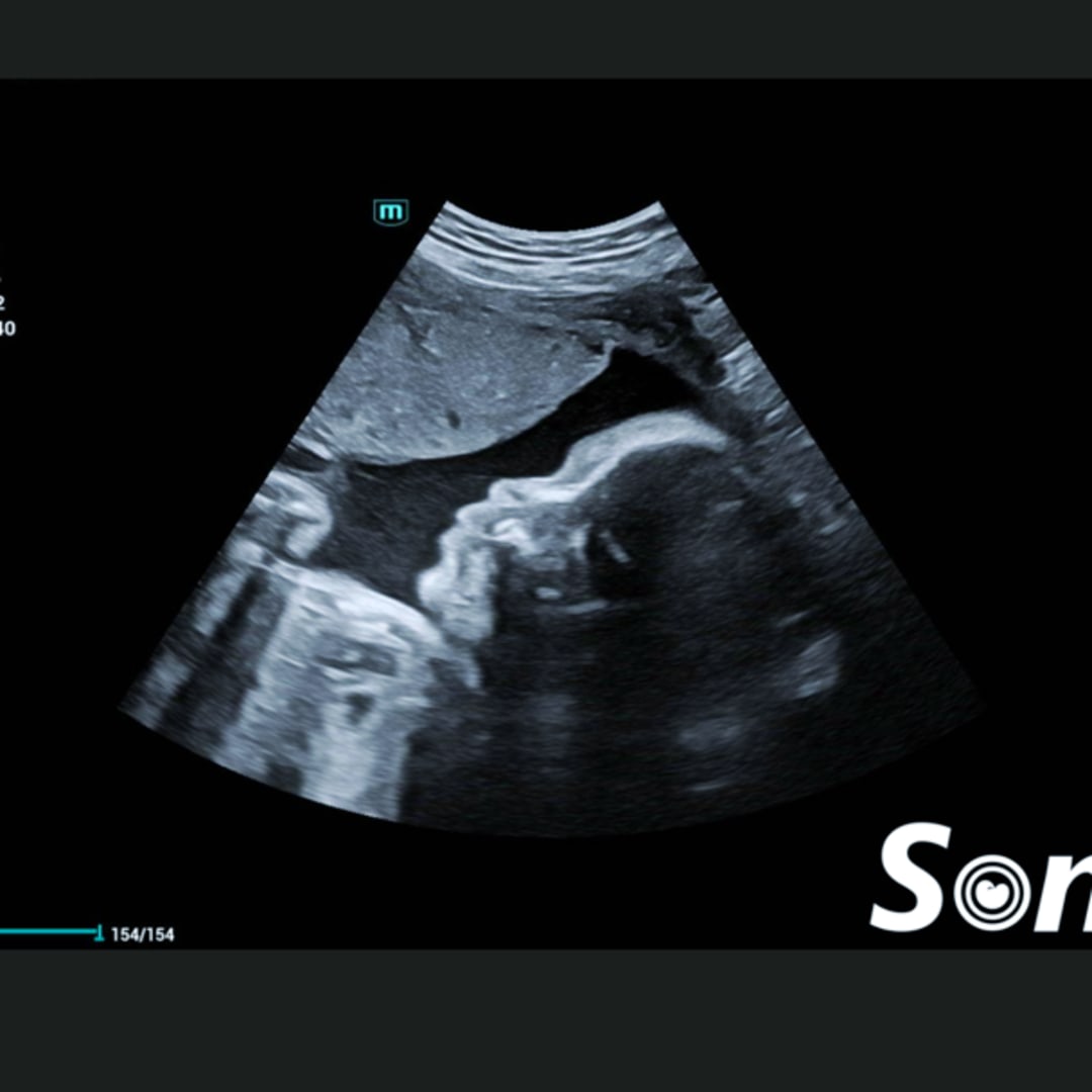 Photo shared by Jaydyn for their Babylist baby registry.