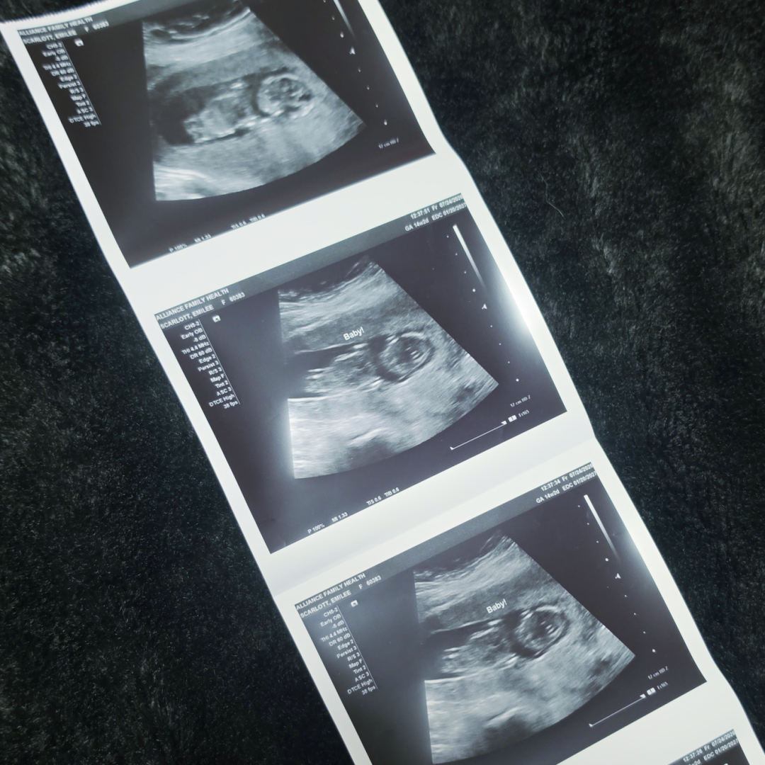 Photo shared by Emilee for their Babylist baby registry.