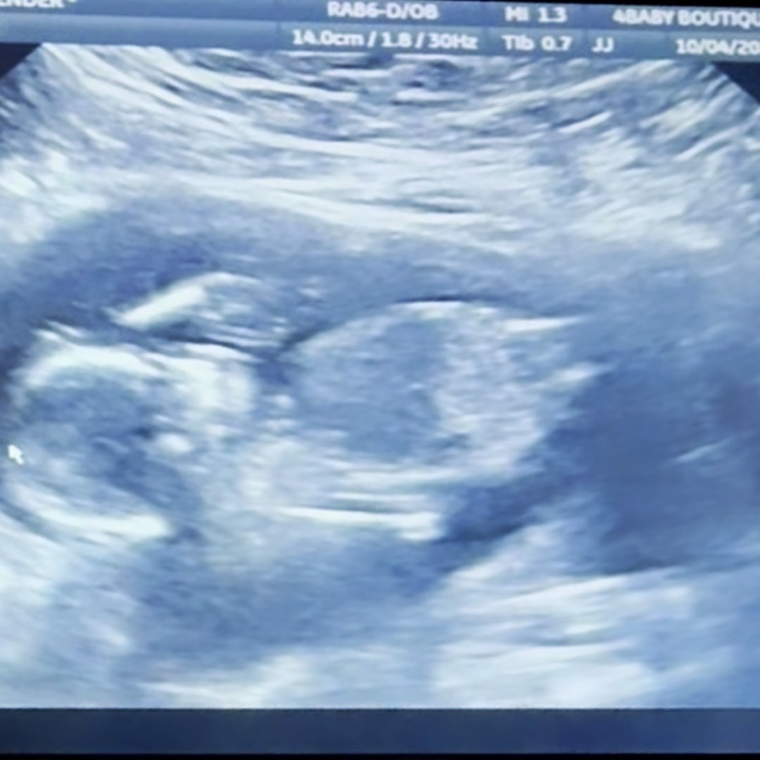 Photo shared by McKenzie for their Babylist baby registry.