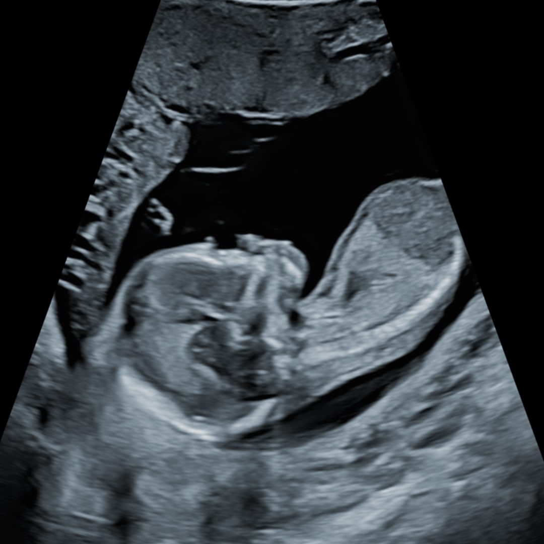Photo shared by A for their Babylist baby registry.