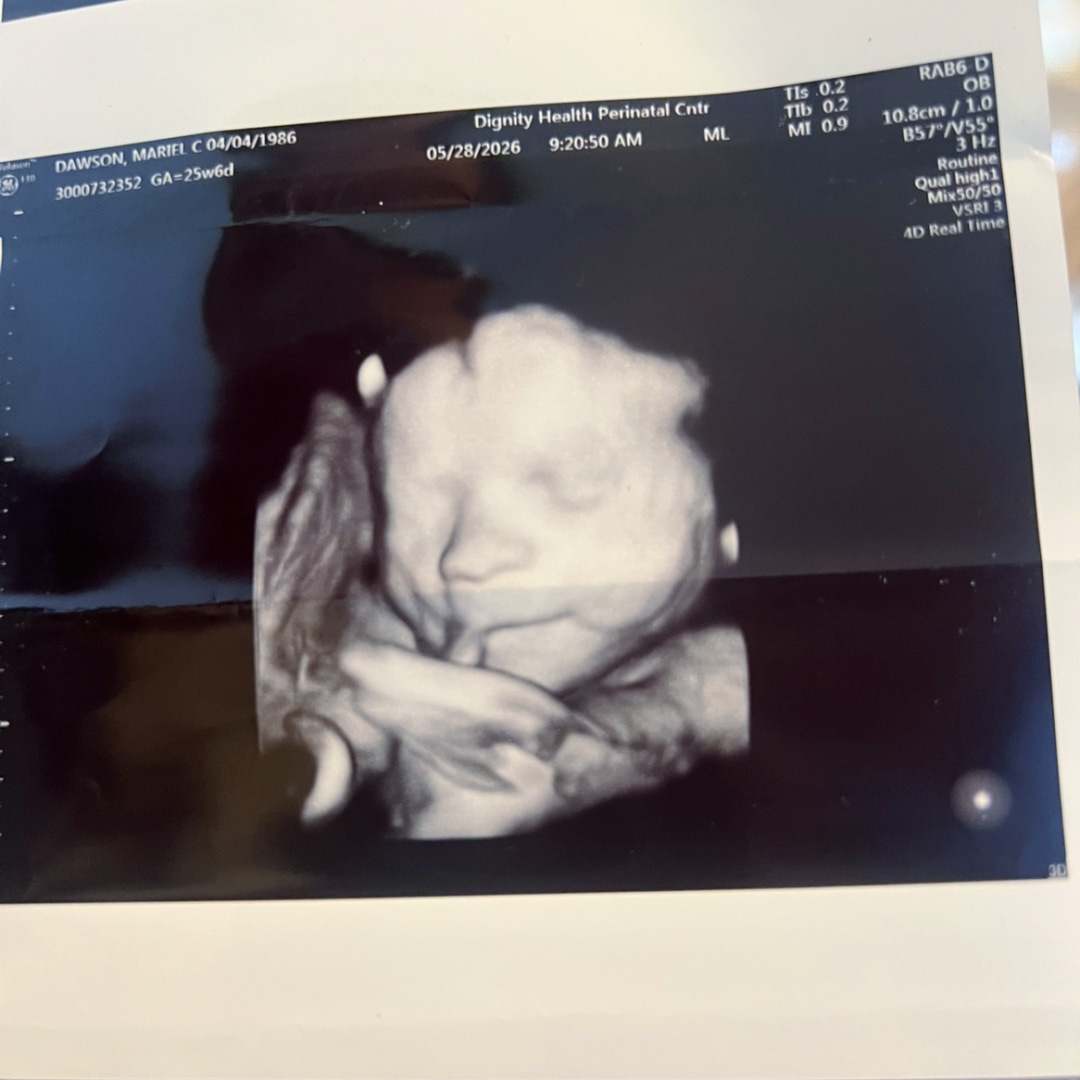 Photo shared by Mariel for their Babylist baby registry.