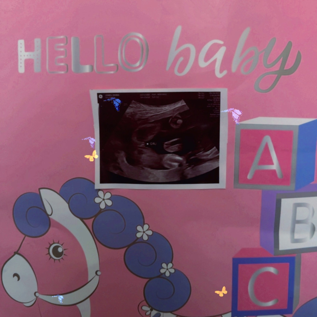 Photo shared by Sierra for their Babylist baby registry.