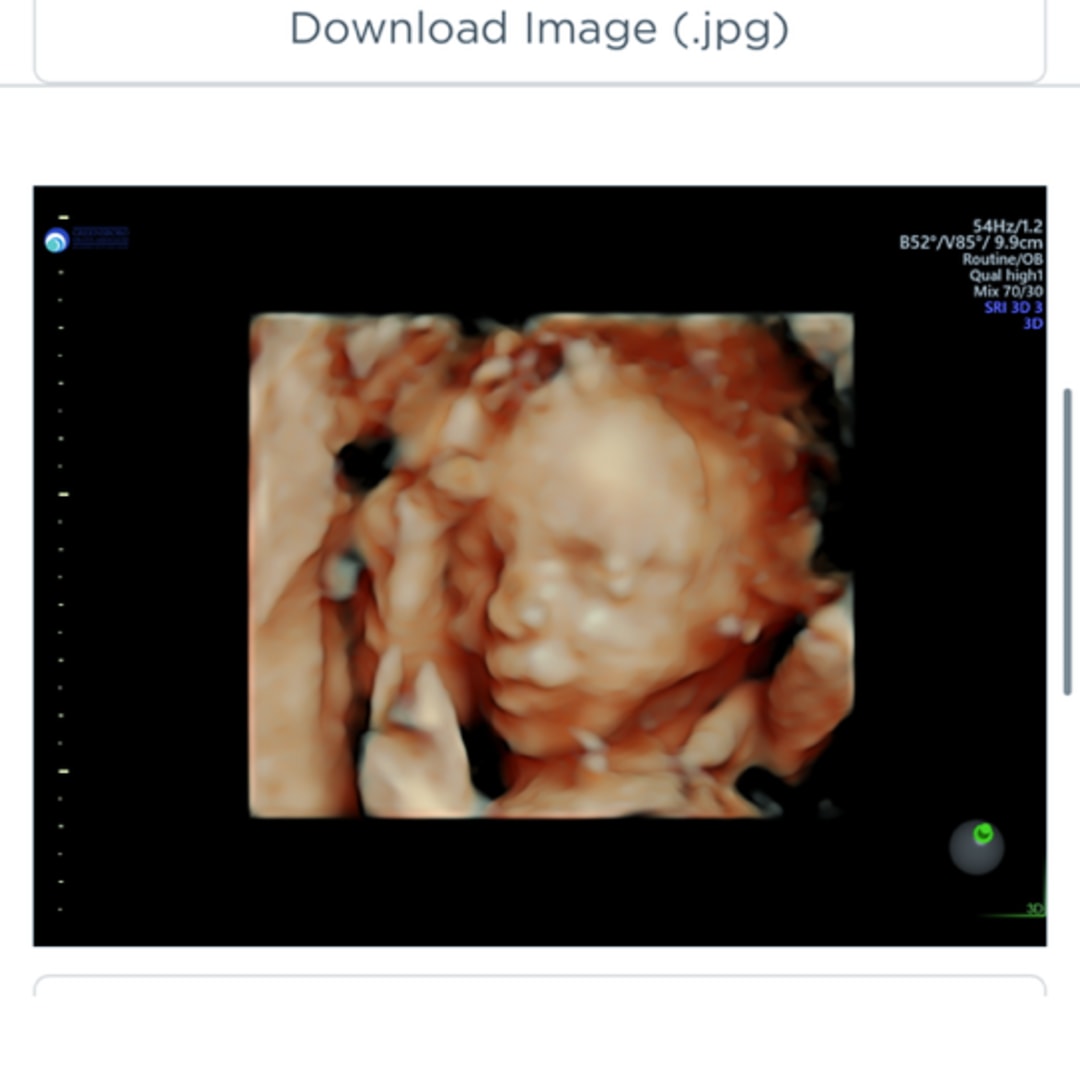 Photo shared by Catherine for their Babylist baby registry.
