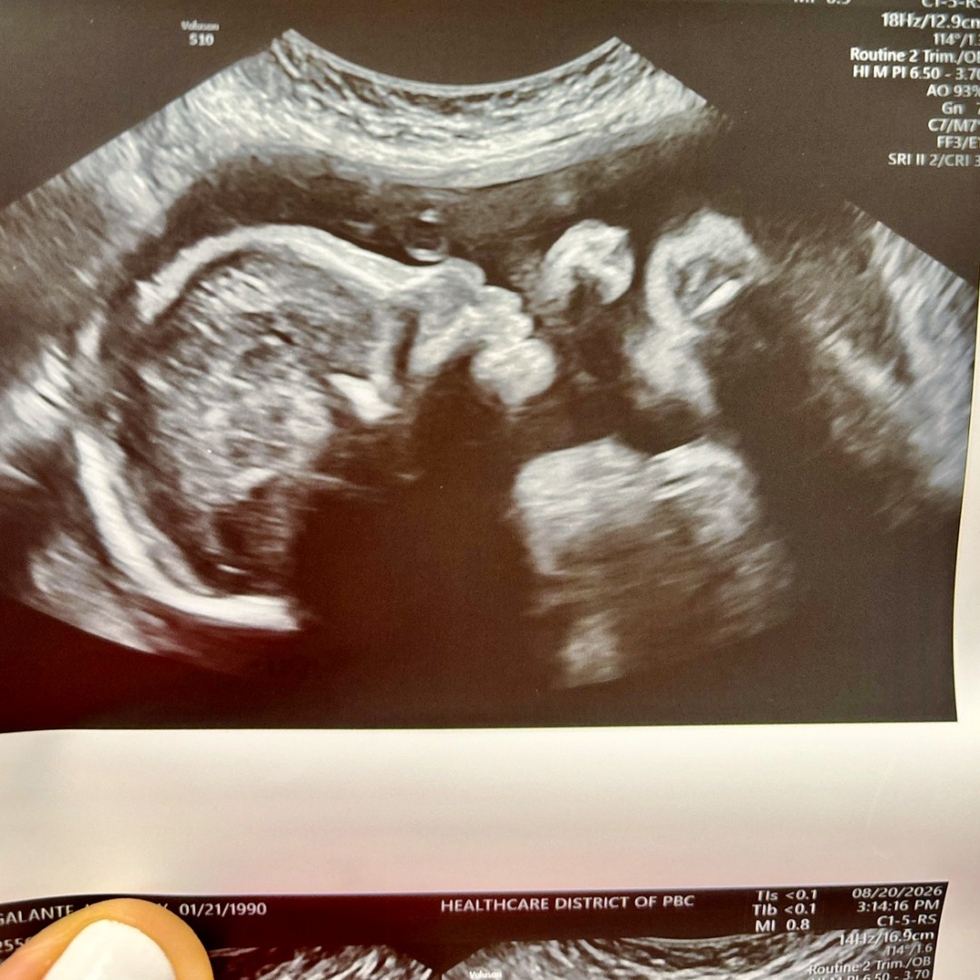Photo shared by Kimberly for their Babylist baby registry.