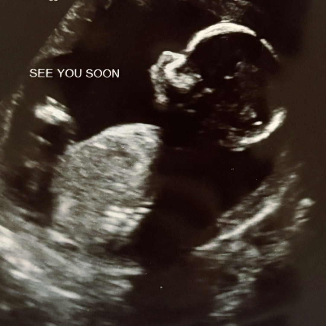 Photo shared by Jordyn for their Babylist baby registry.