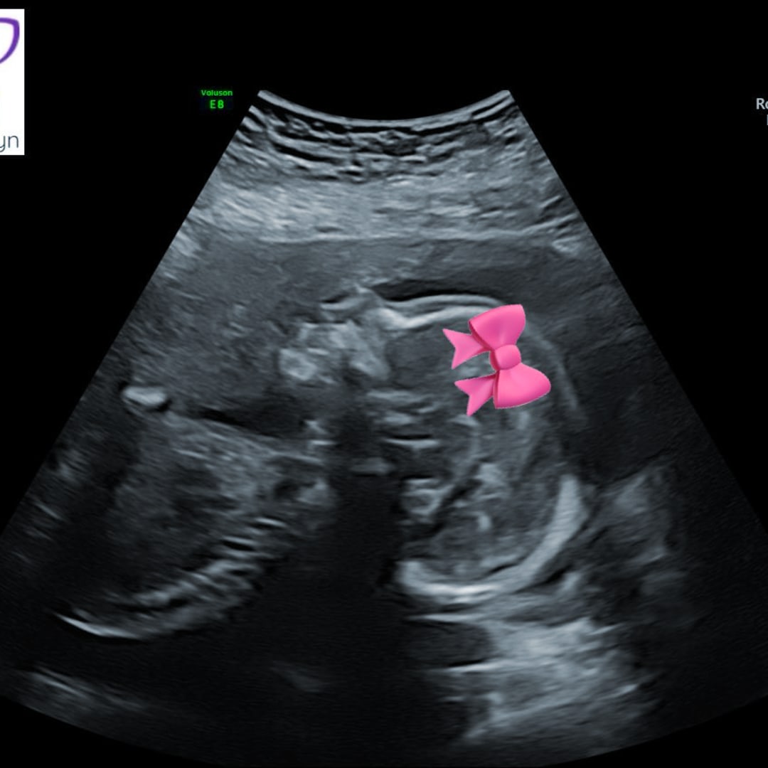 Photo shared by Alexis for their Babylist baby registry.