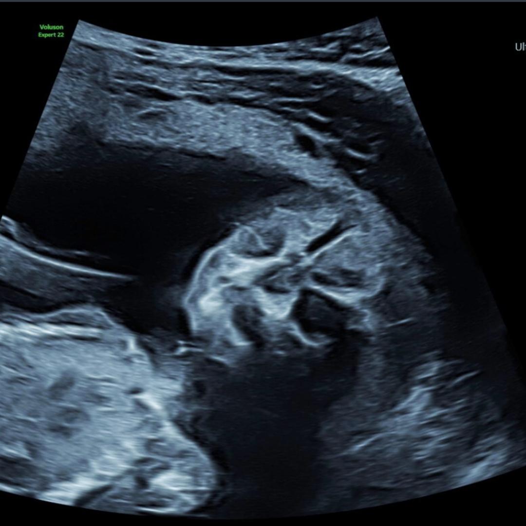 Photo shared by Alex for their Babylist baby registry.