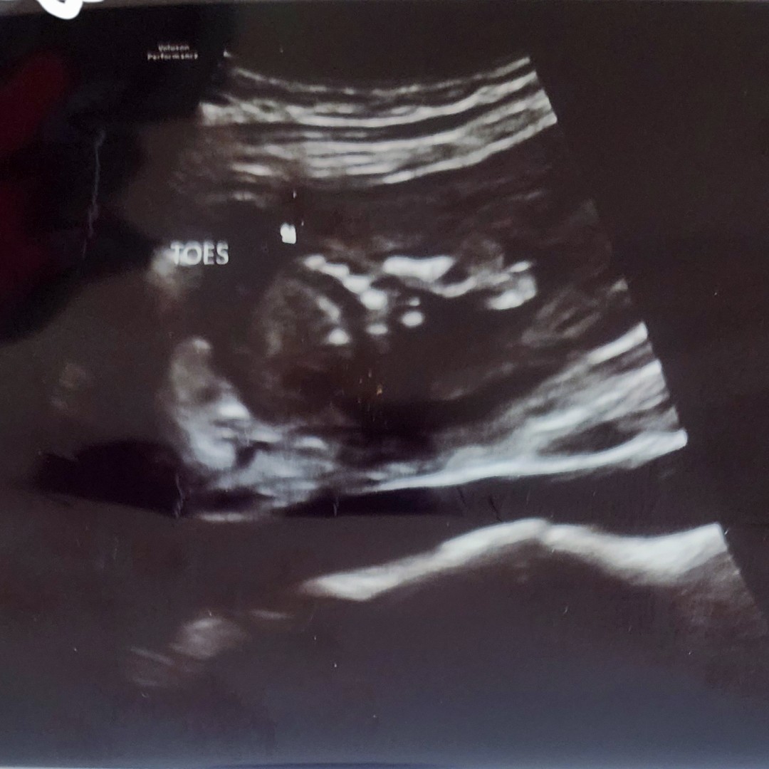 Photo shared by Danielle for their Babylist baby registry.