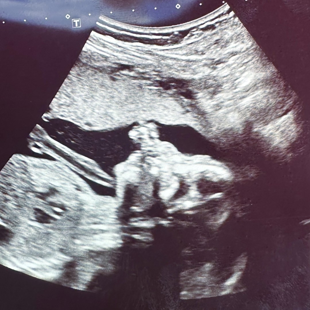 Photo shared by Maleah for their Babylist baby registry.
