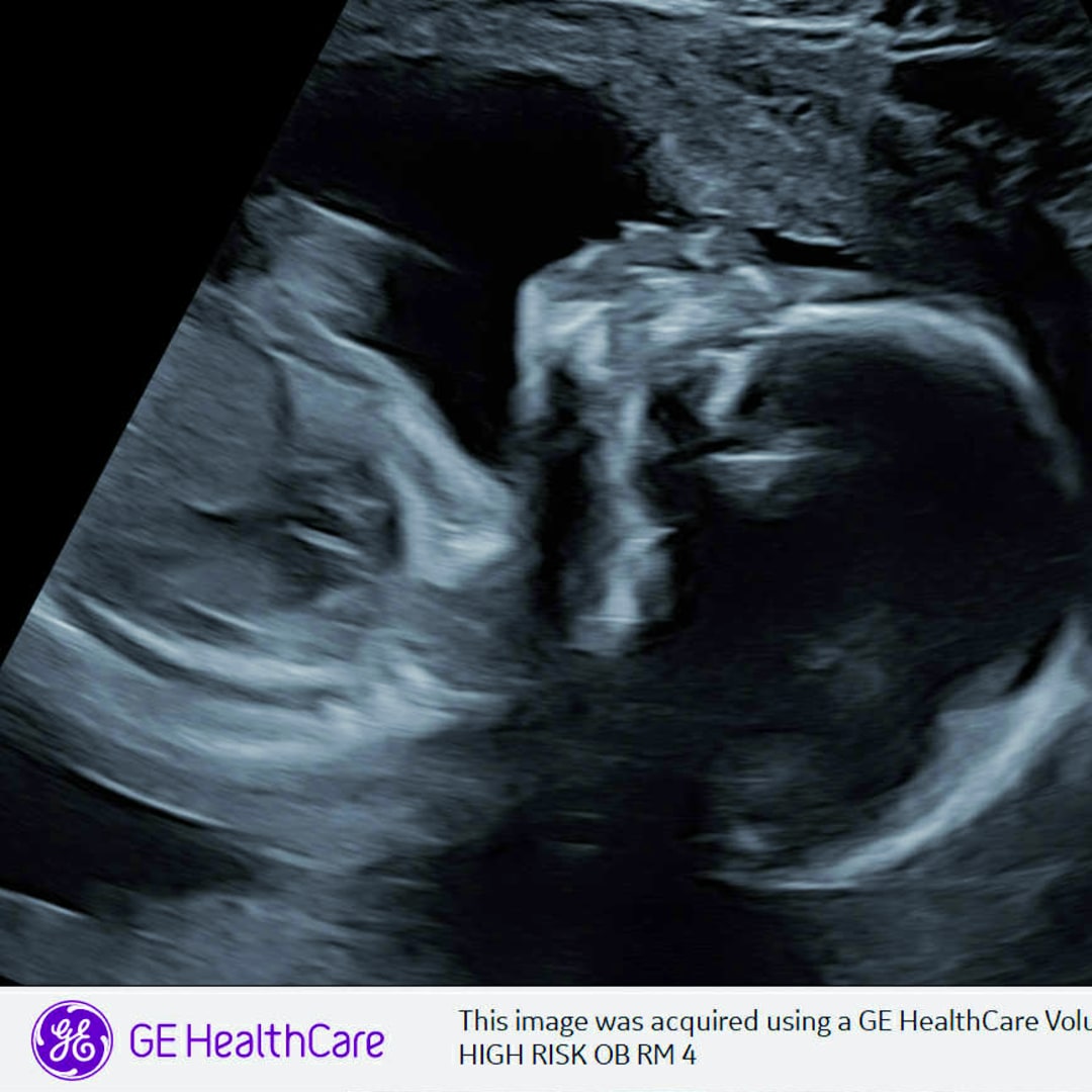 Photo shared by Grace for their Babylist baby registry.