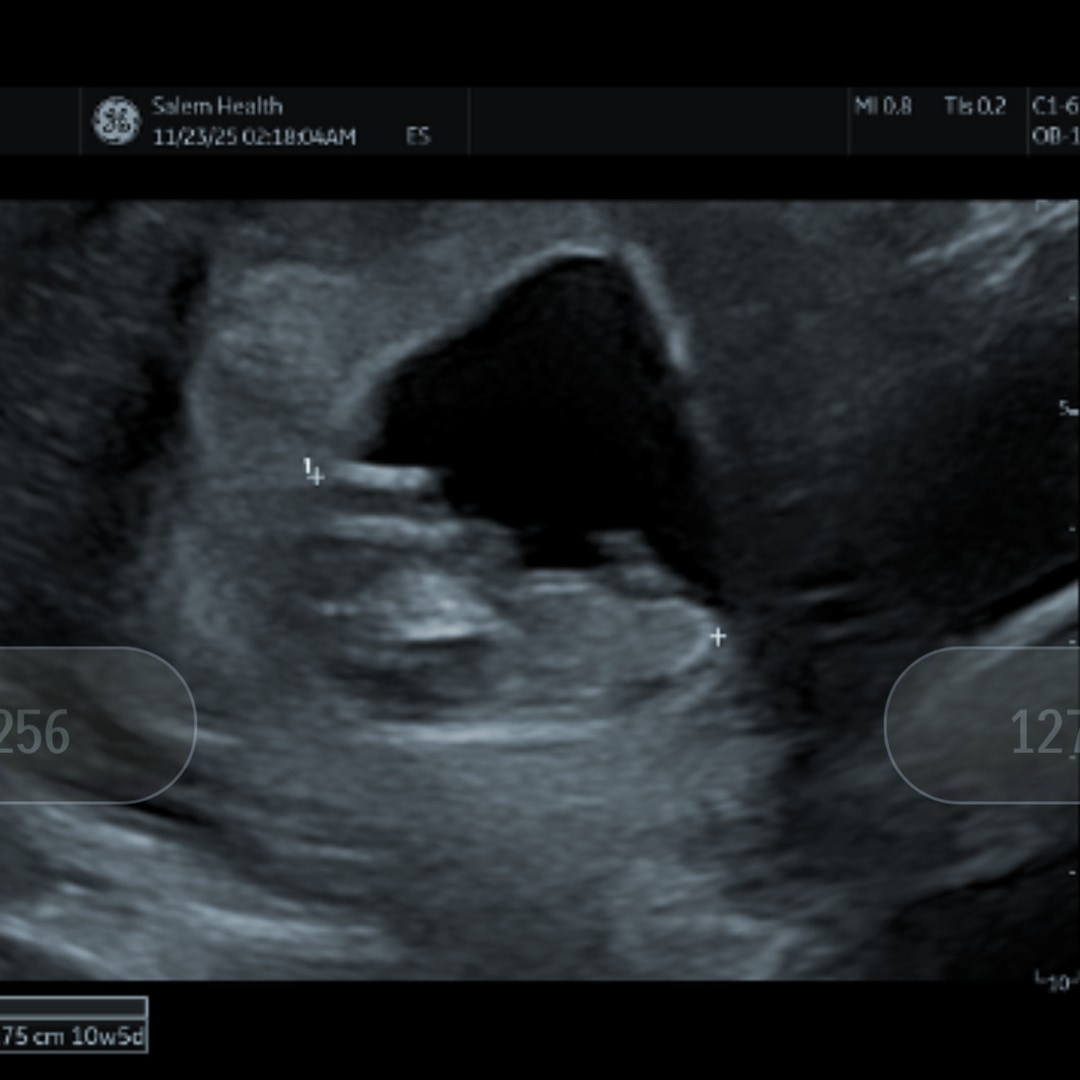 Photo shared by Holly for their Babylist baby registry.