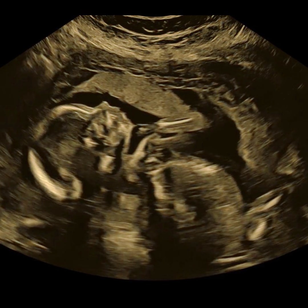 Photo shared by Haley for their Babylist baby registry.
