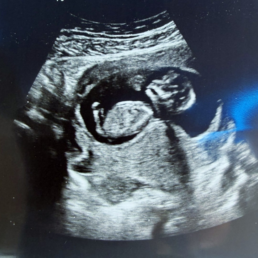 Photo shared by Pearla for their Babylist baby registry.