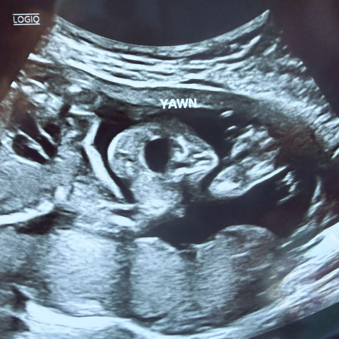Photo shared by Courtney for their Babylist baby registry.