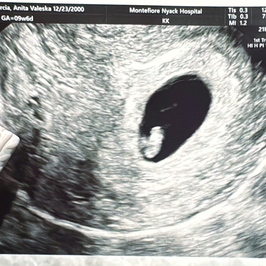 Photo shared by Anita for their Babylist baby registry.