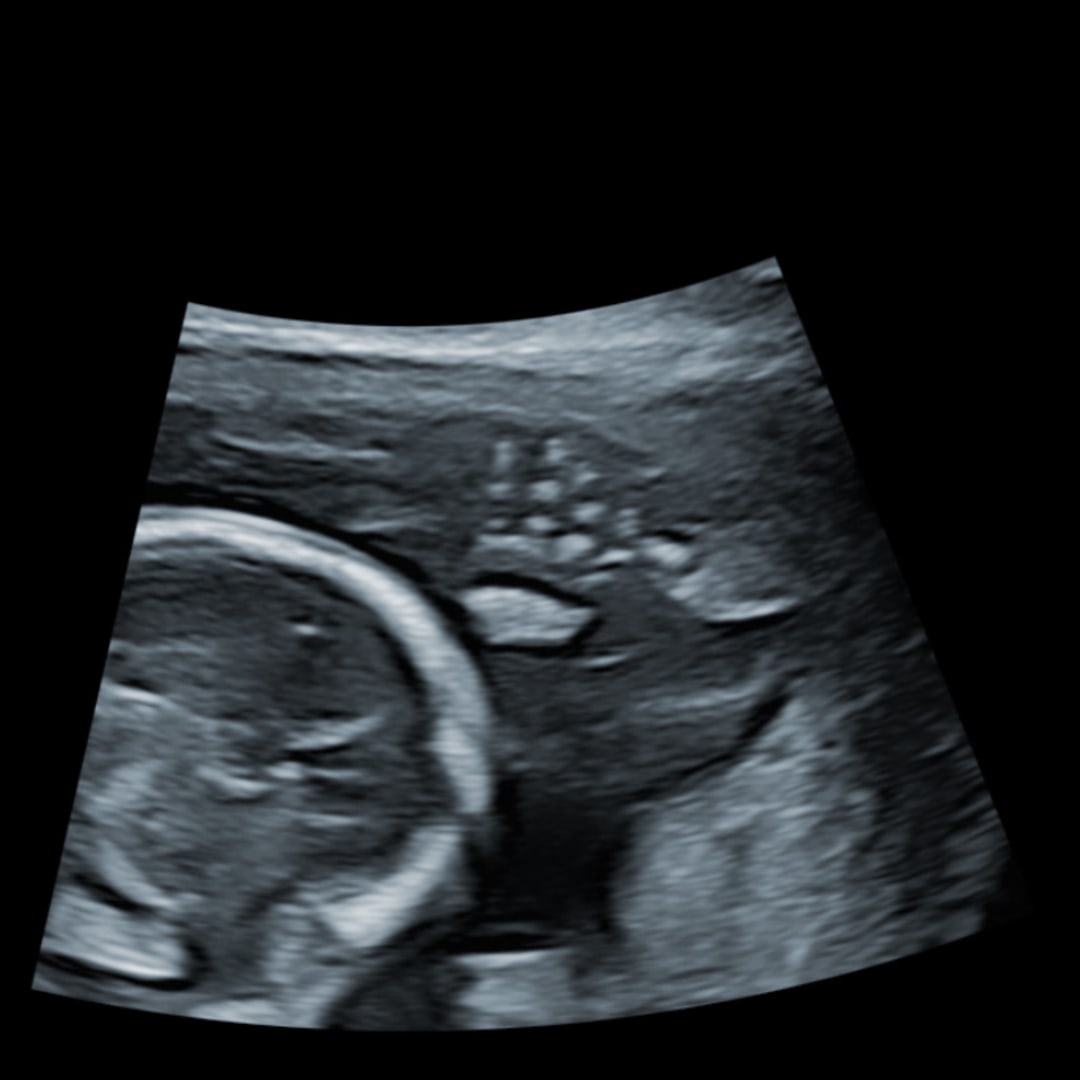 Photo shared by Kath for their Babylist baby registry.