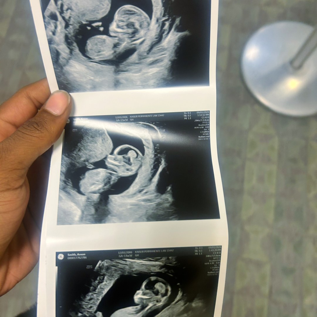 Photo shared by Exavier for their Babylist baby registry.