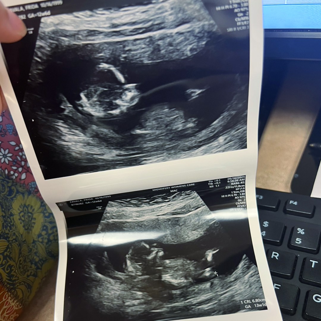 Photo shared by Frida for their Babylist baby registry.
