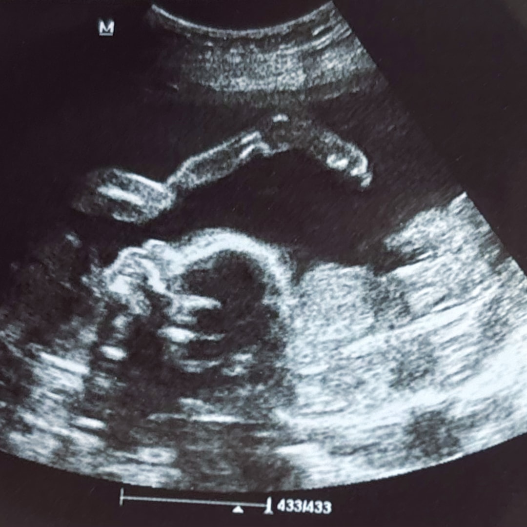 Photo shared by Kaydence for their Babylist baby registry.