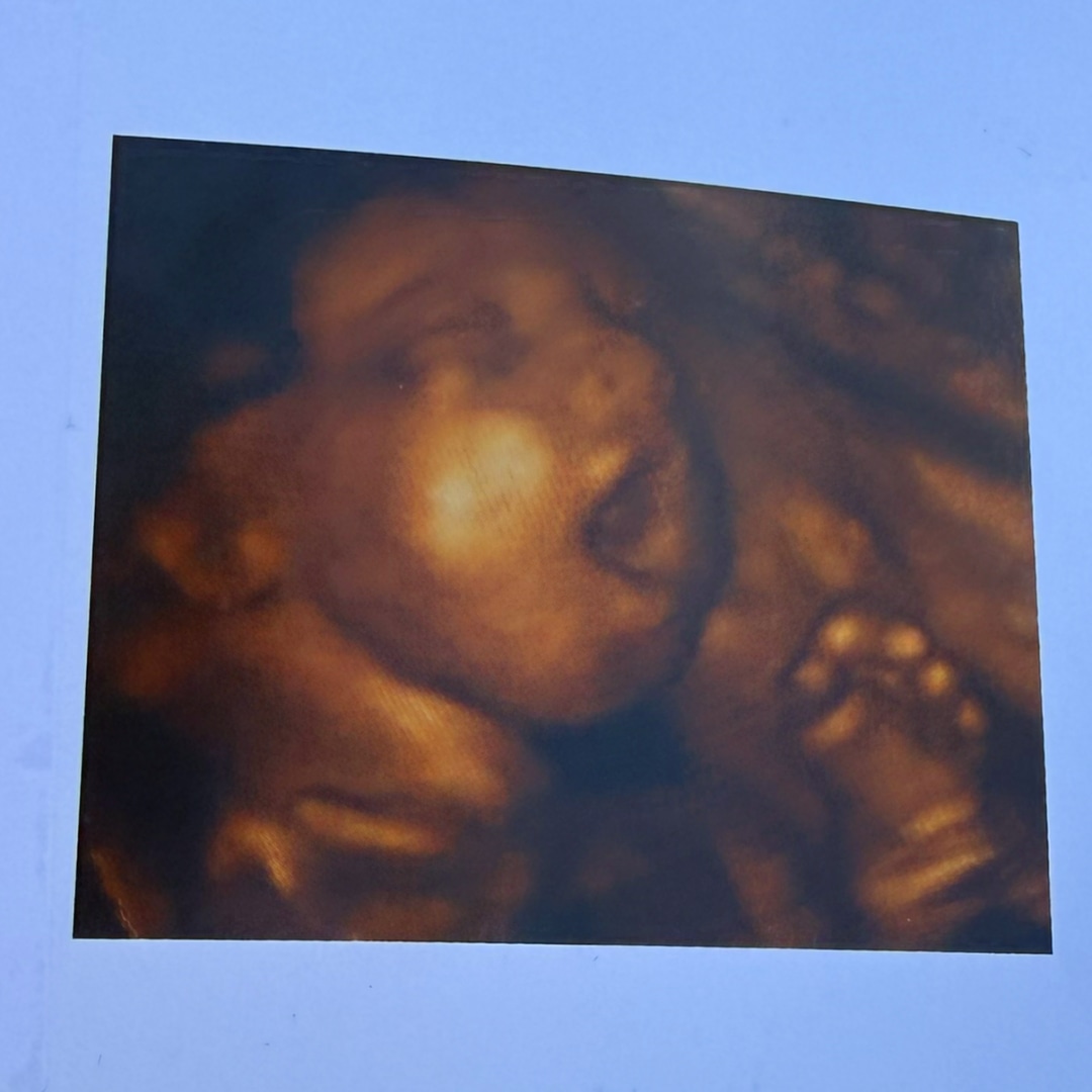 Photo shared by Jasmine for their Babylist baby registry.