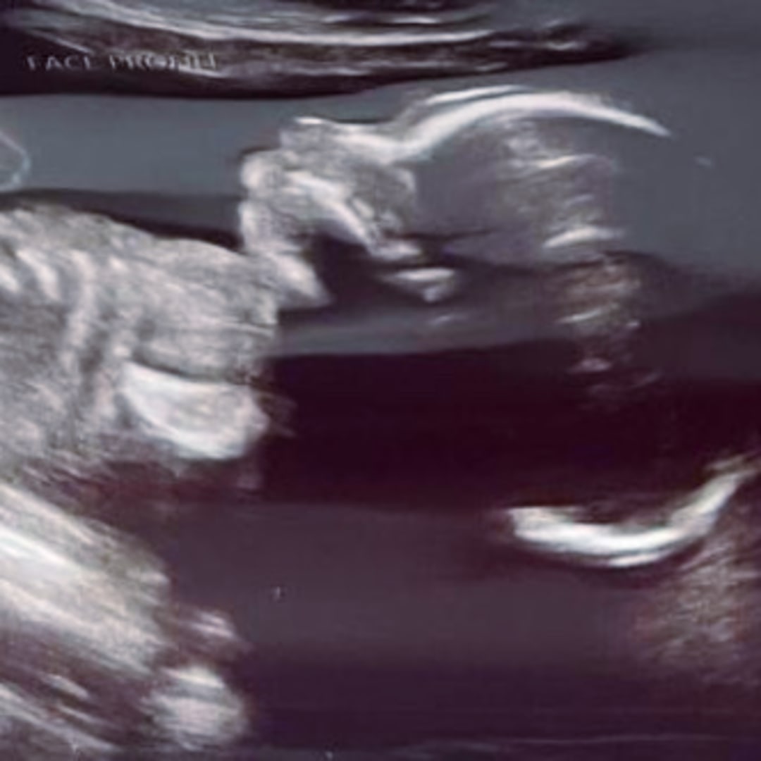 Photo shared by Kailynn for their Babylist baby registry.