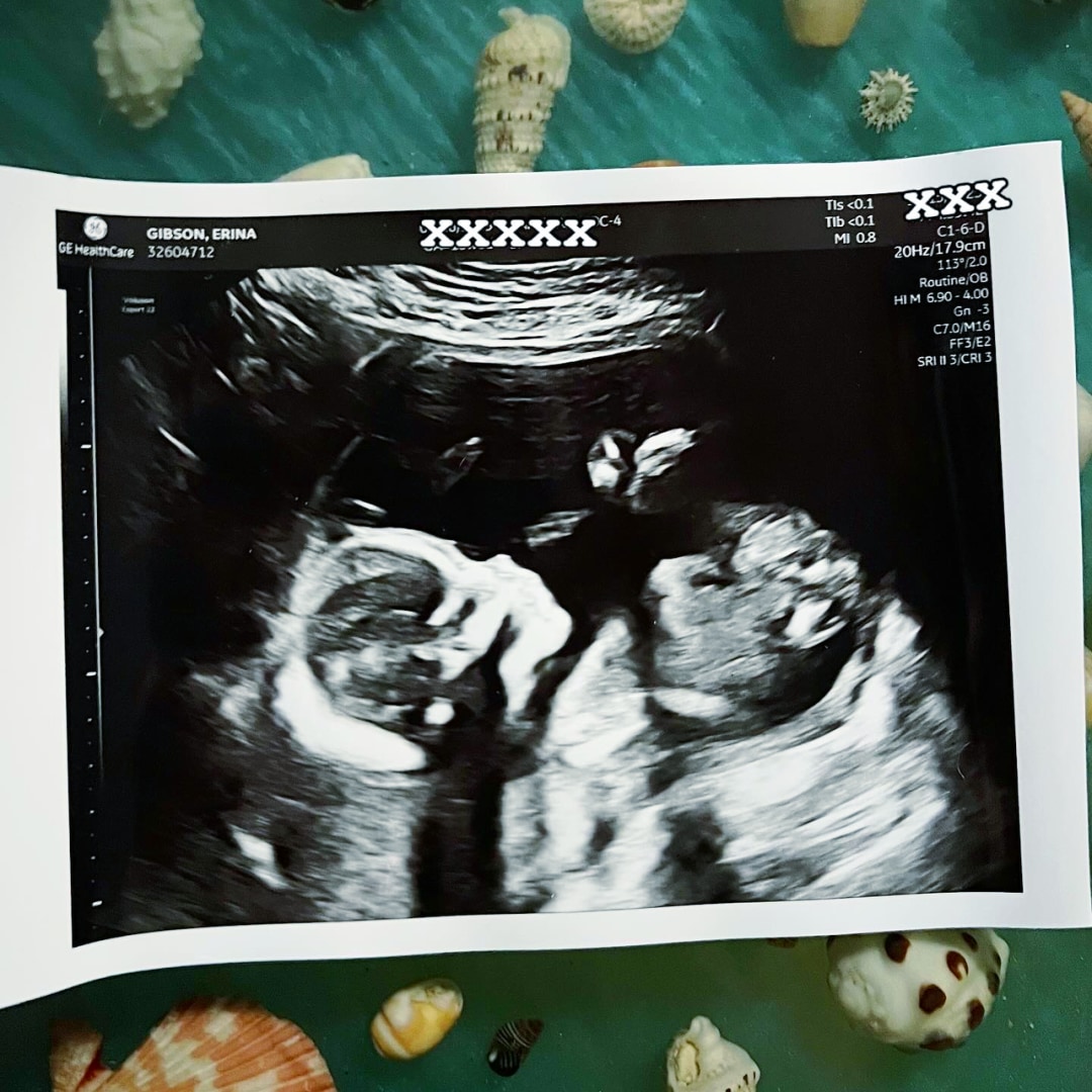 Photo shared by Erina for their Babylist baby registry.