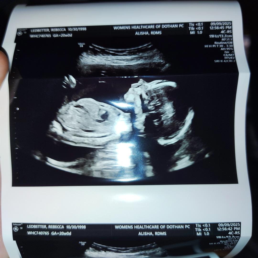 Photo shared by Rebecca for their Babylist baby registry.