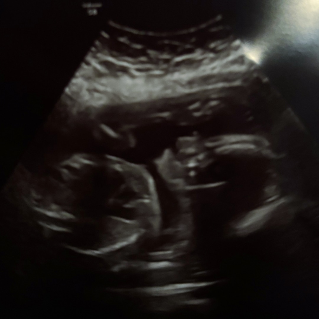 Photo shared by Peyton for their Babylist baby registry.
