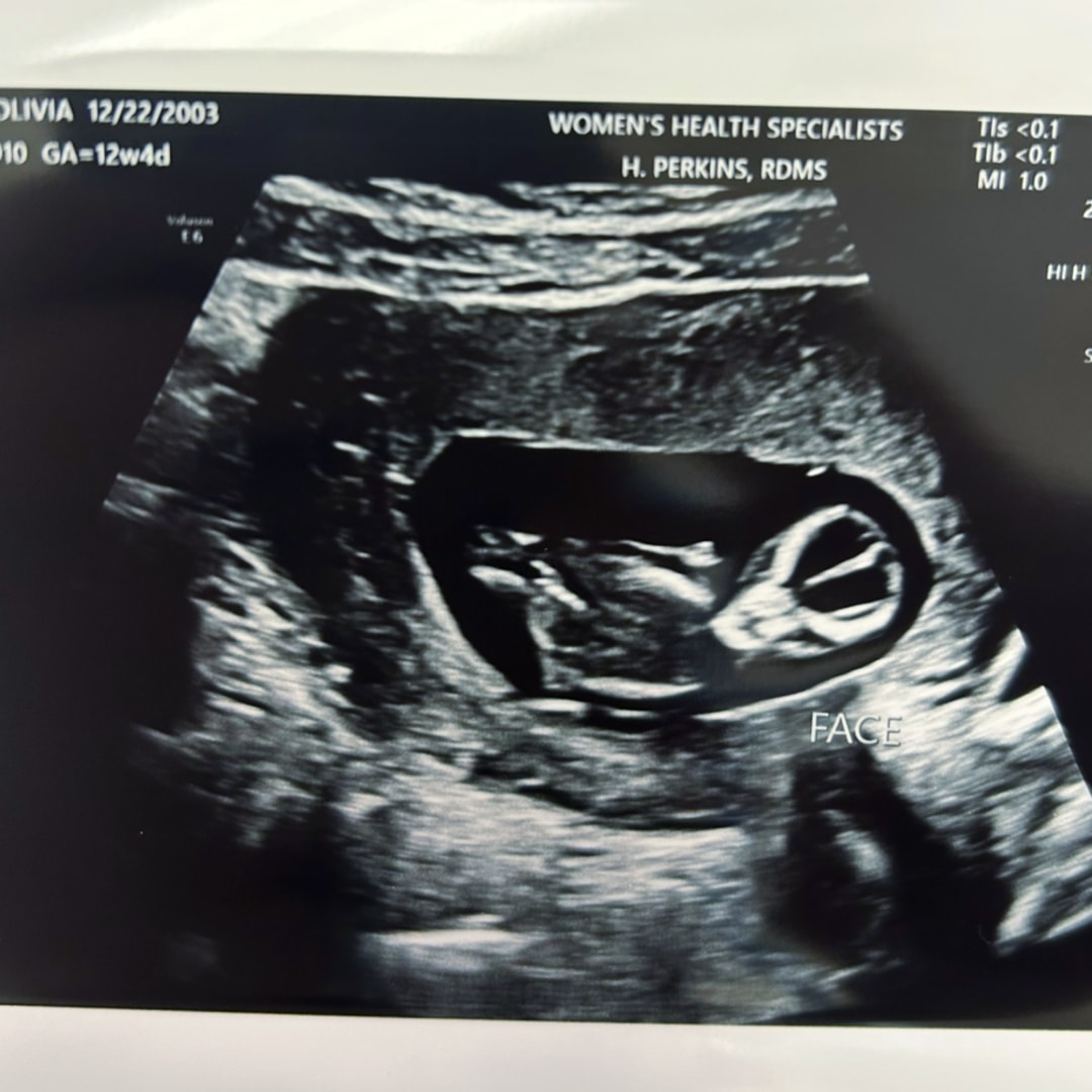 Photo shared by Olivia for their Babylist baby registry.