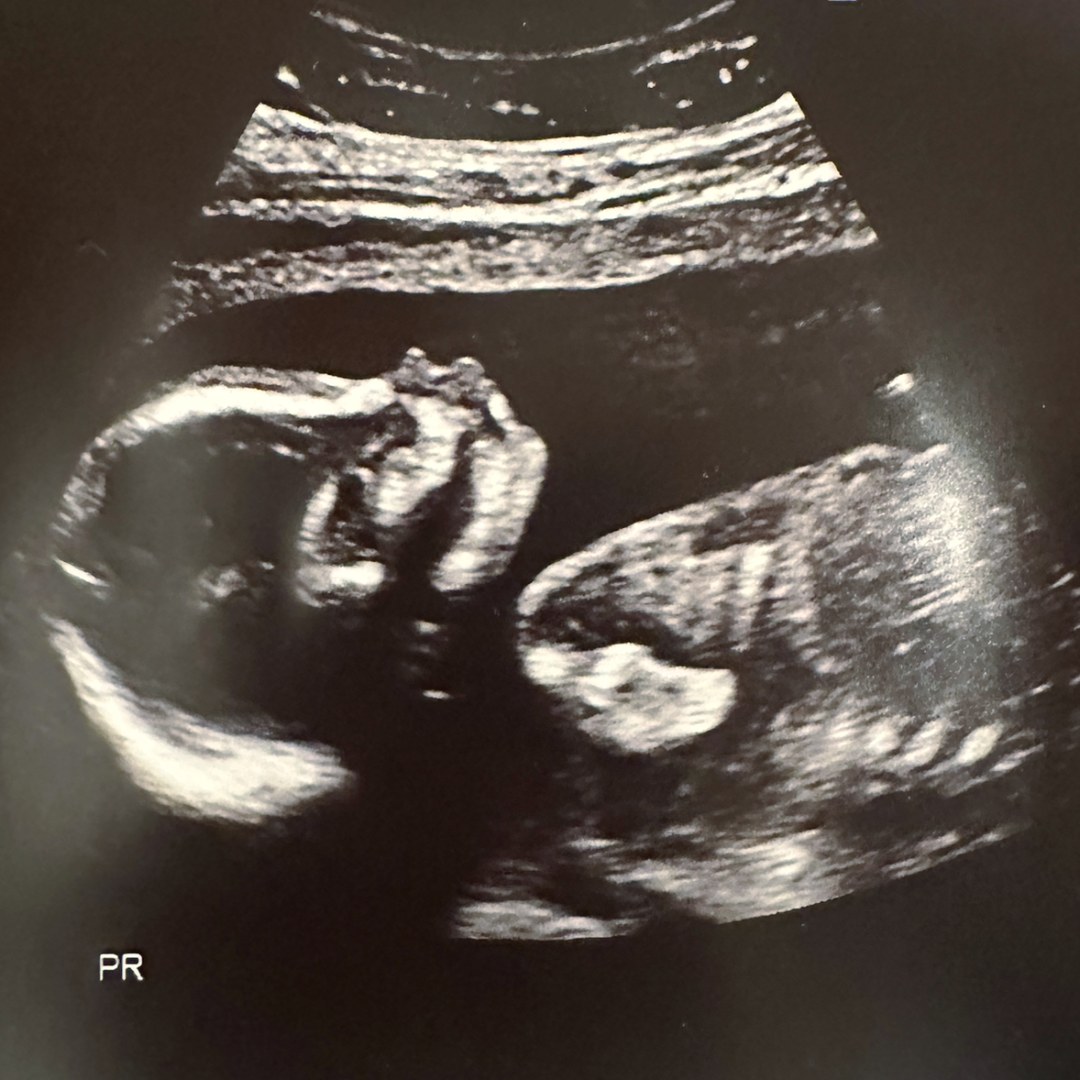 Photo shared by Spencer for their Babylist baby registry.