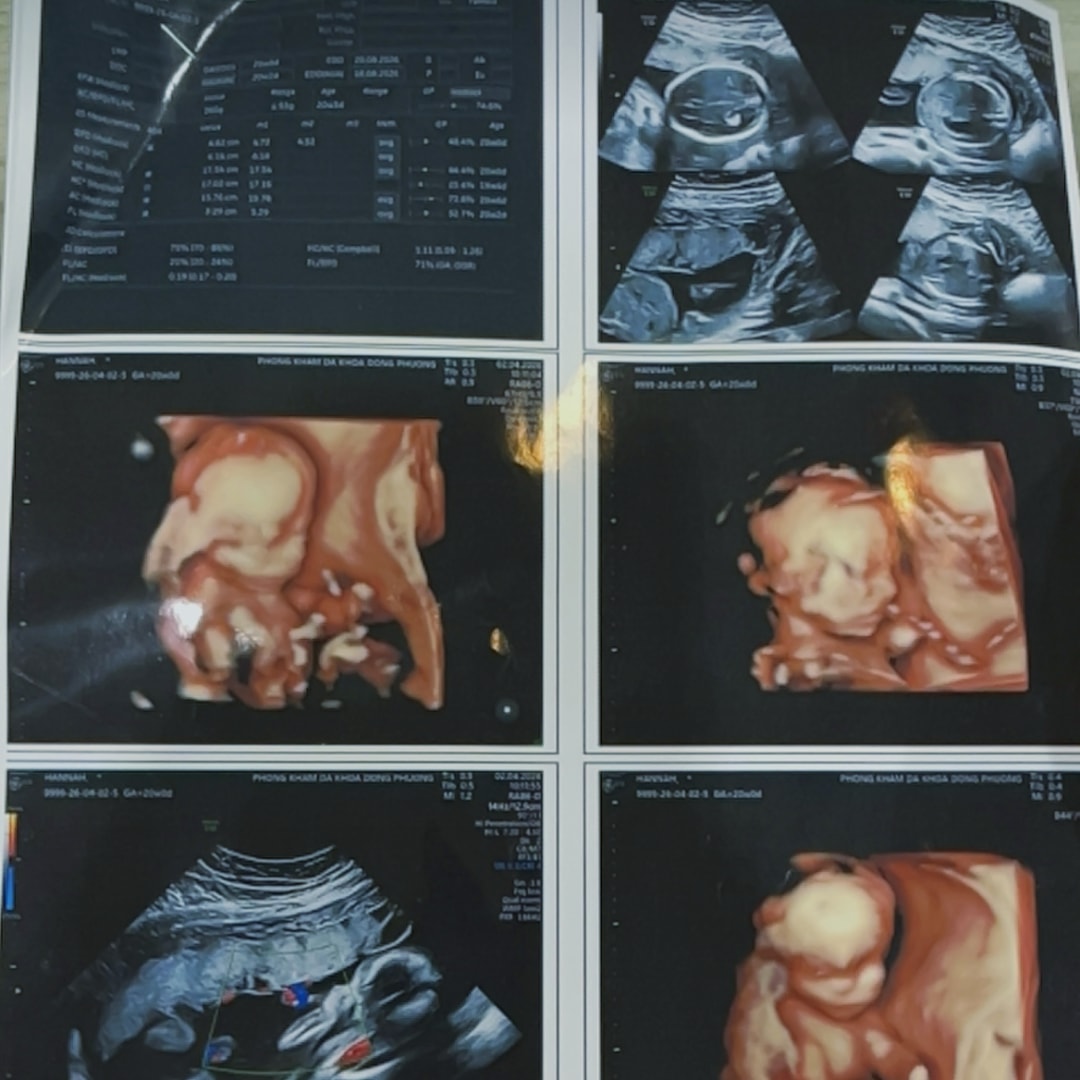 Photo shared by Hannah for their Babylist baby registry.