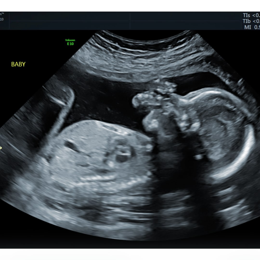 Photo shared by Malia for their Babylist baby registry.