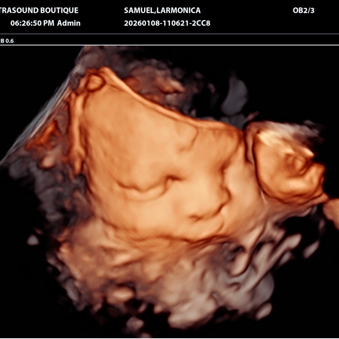 Photo shared by Larmonica for their Babylist baby registry.