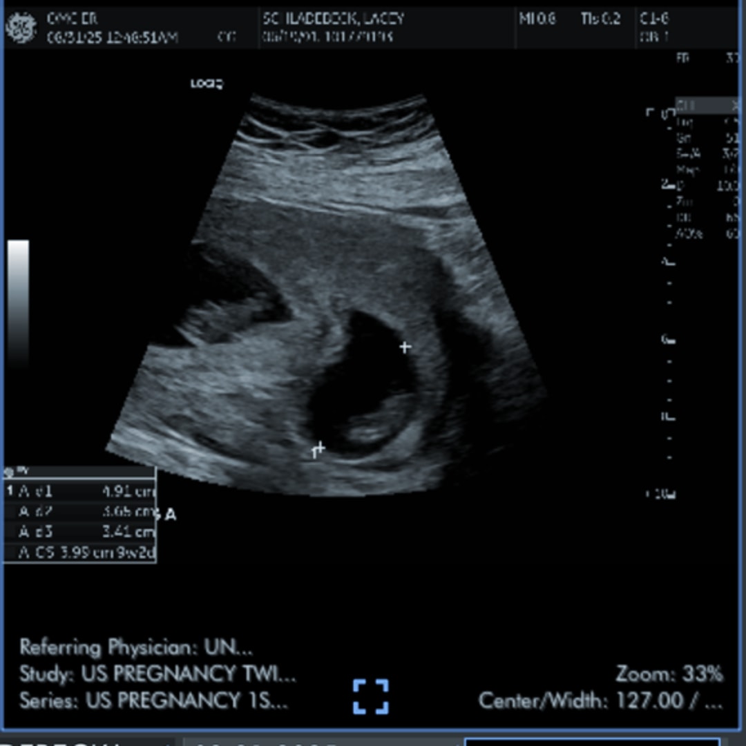 Photo shared by Lacey for their Babylist baby registry.