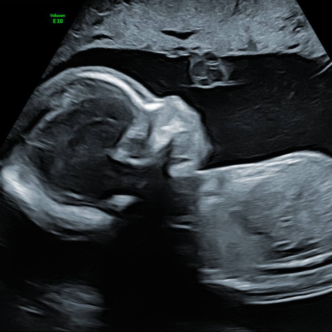 Photo shared by Destiney for their Babylist baby registry.