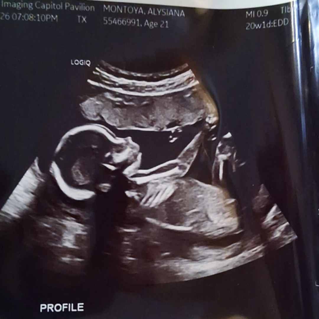 Photo shared by Alysiana for their Babylist baby registry.