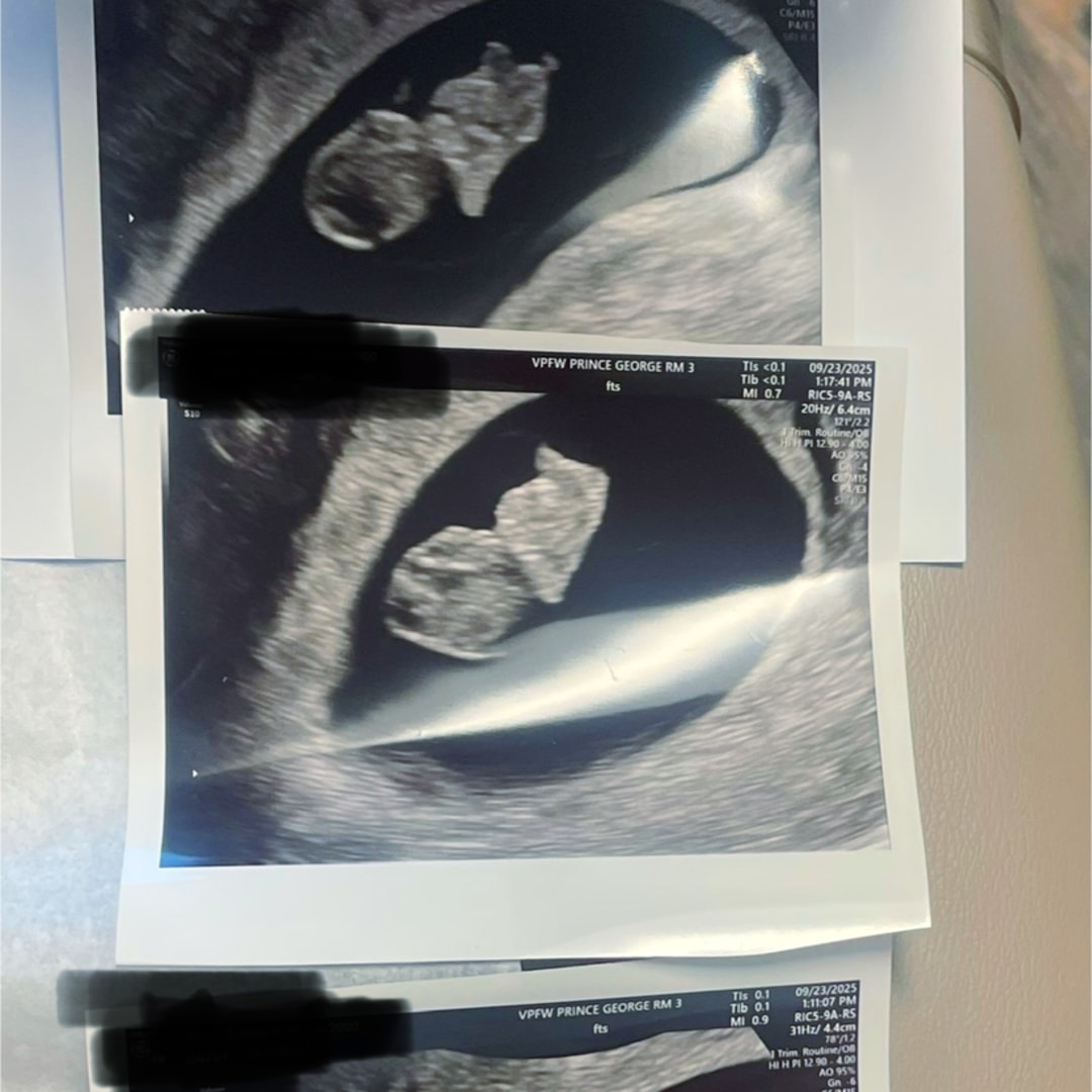 Photo shared by Aylissa for their Babylist baby registry.