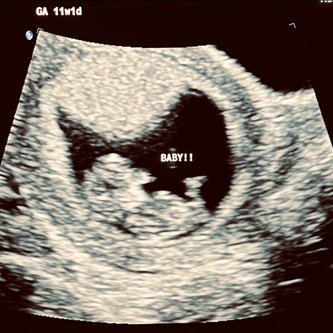 Photo shared by Daveigh for their Babylist baby registry.